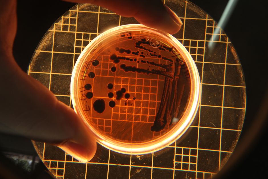 The Microbiological Horizontal Gene Transfer Framework Shift Rewriting Evolutionary Biology